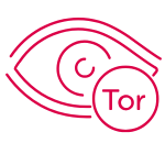 Toric Contact Lenses